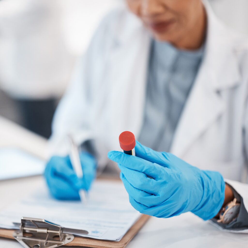 alcohol blooding testing alcohol blooding testing