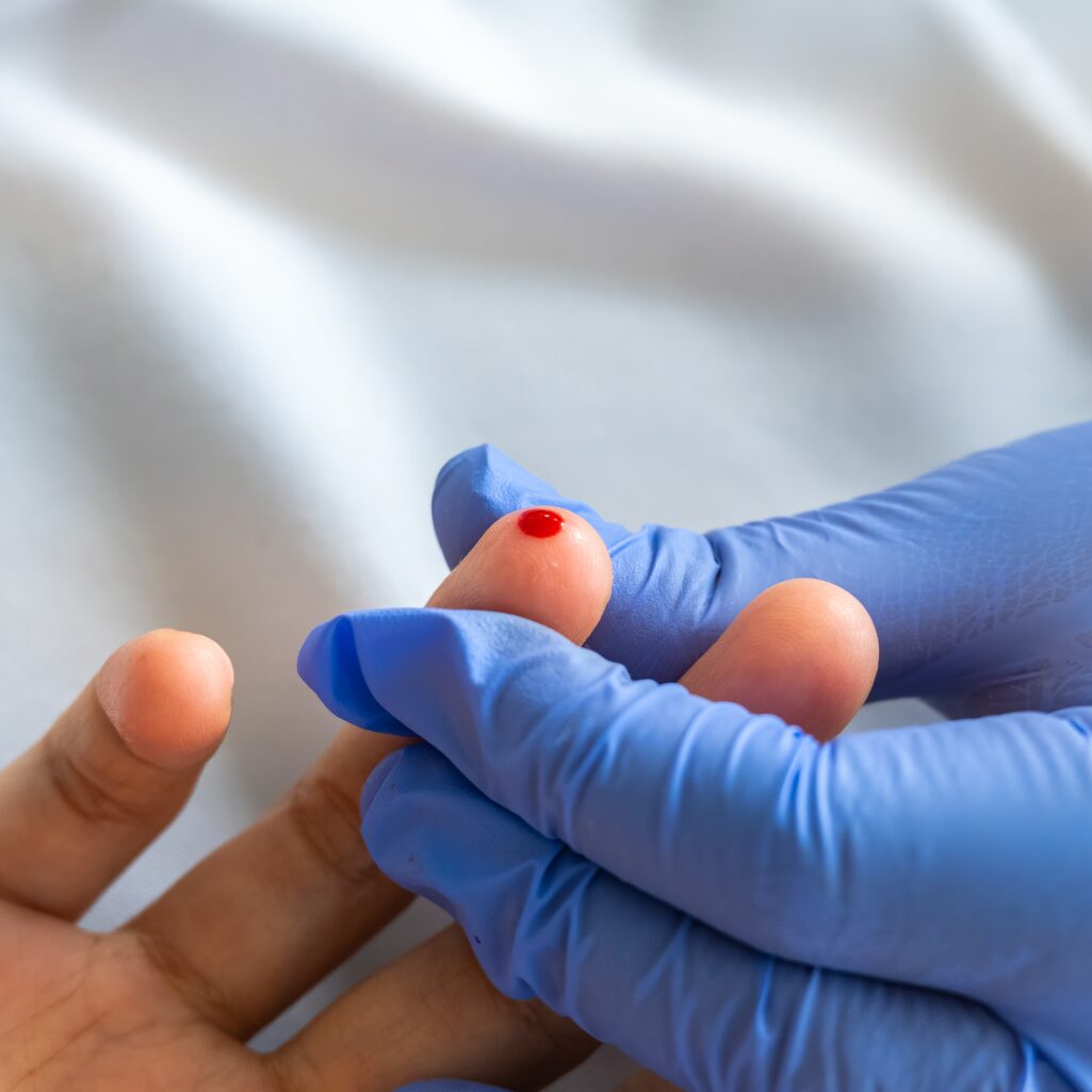 blood testing PEth tests blood testing PEth tests